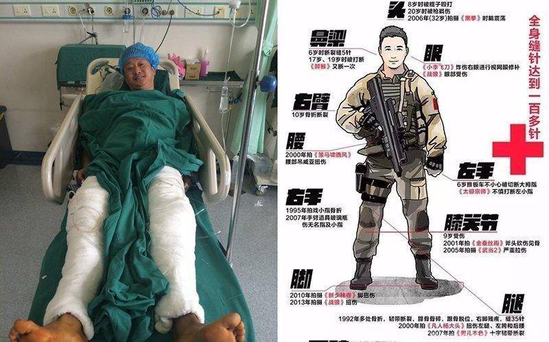 吴京_观众_受伤