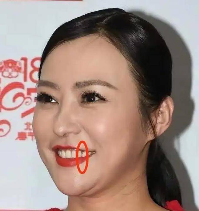 年轻时的郝蕾拍过很多活泼俏皮的小女生形象,大家似乎只记住了她的