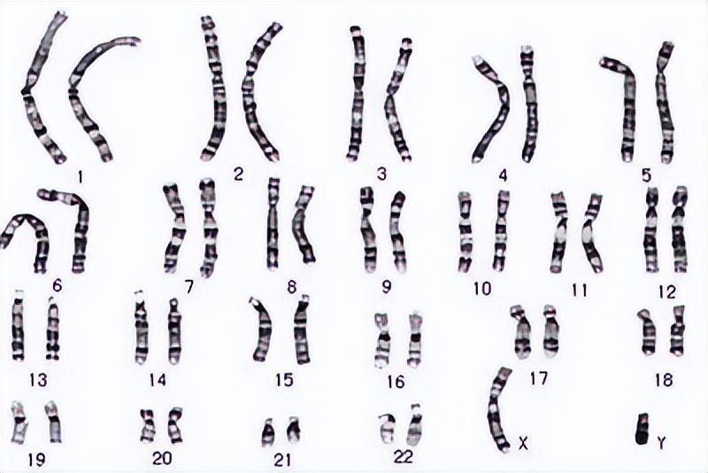 8号染色体异常图片
