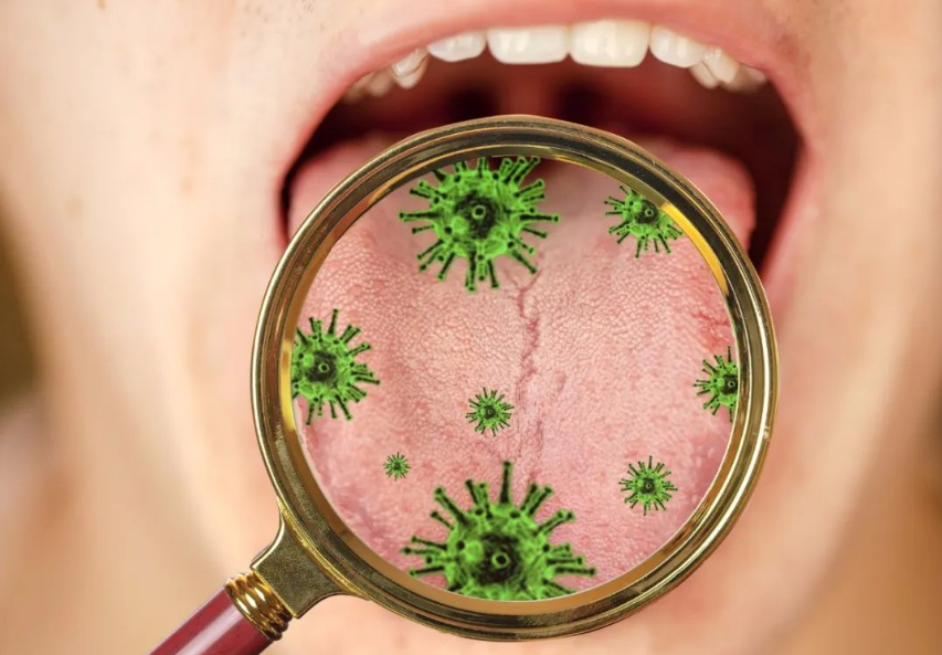 牙石口臭不要傻傻洗牙!掌握四个低成本方法,清新口气太容易了!