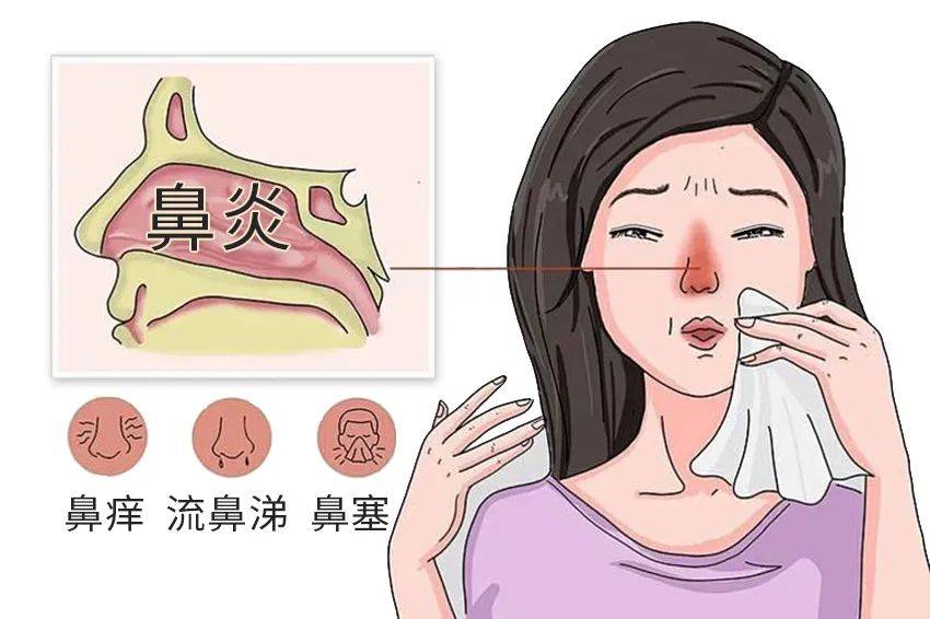 百草益寿:春季鼻炎多发,一味药多闻闻,通鼻窍,散风寒_治疗_功效_方法