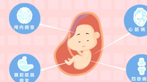 孕期为什么要做四维彩超?_胎儿_进行_结构