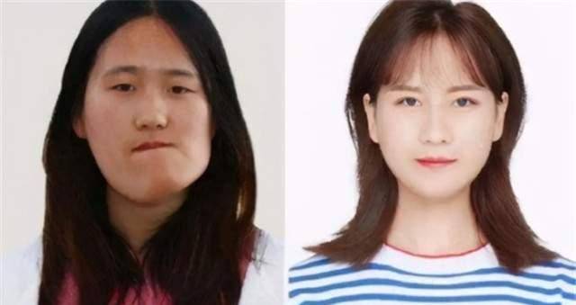 "歪脸女孩"赵宏秋,受资助变女神,舍弃百万年薪当老师