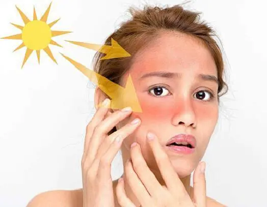 豹纹妈妈:为什么你更容易被晒黑?_皮肤_紫外线_保护