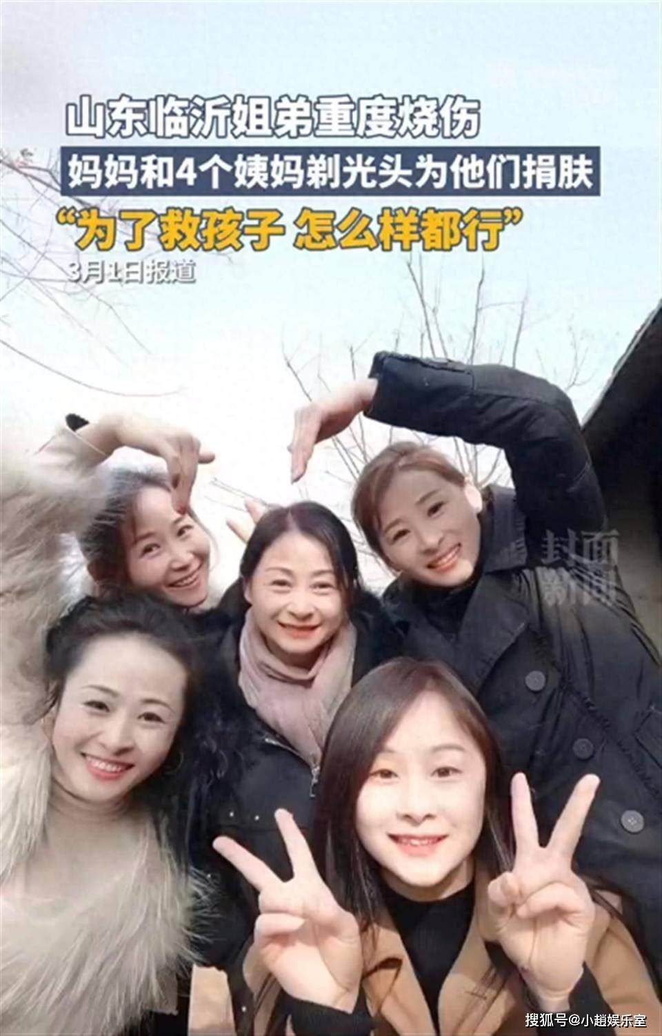 姐弟烧伤4位姨妈剃光头捐皮肤,网友评论:世界上最美的姨妈_亲情_关系