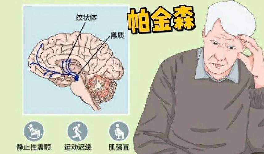 特发性震颤会慢慢发展成帕金森病吗?_疾病_患者_姿势