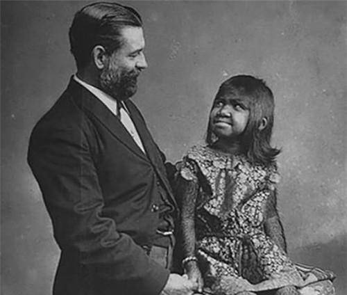 原创1881年被探险队抓到的野人女孩结局如何遗言让现代人心酸