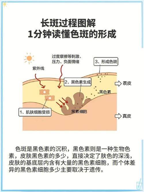 从根源上了解色斑