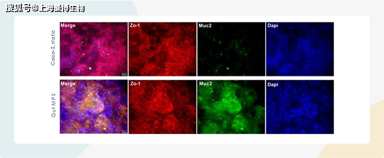 利用肠道微生理系统预测人体药物渗透性微流控器官芯片曼博生物