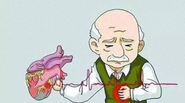 原创心源性休克心脏发出求救信号了掌握5大预防策略守护生命