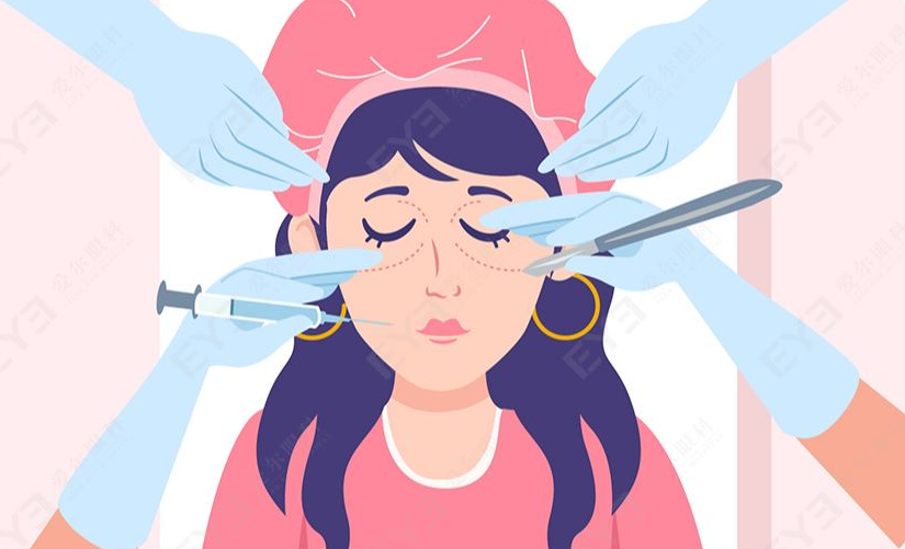 近视手术有哪些姐妹们都关心的点?一文解答,女生进!_角膜_建议_眼睛