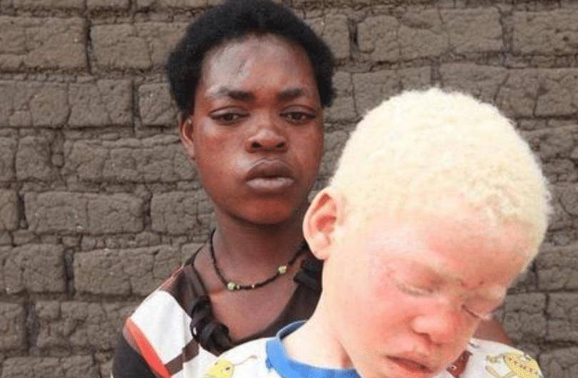 非洲的特殊人群,血液比"黄金"还珍贵,警察24小时贴身保护_黑人_白人