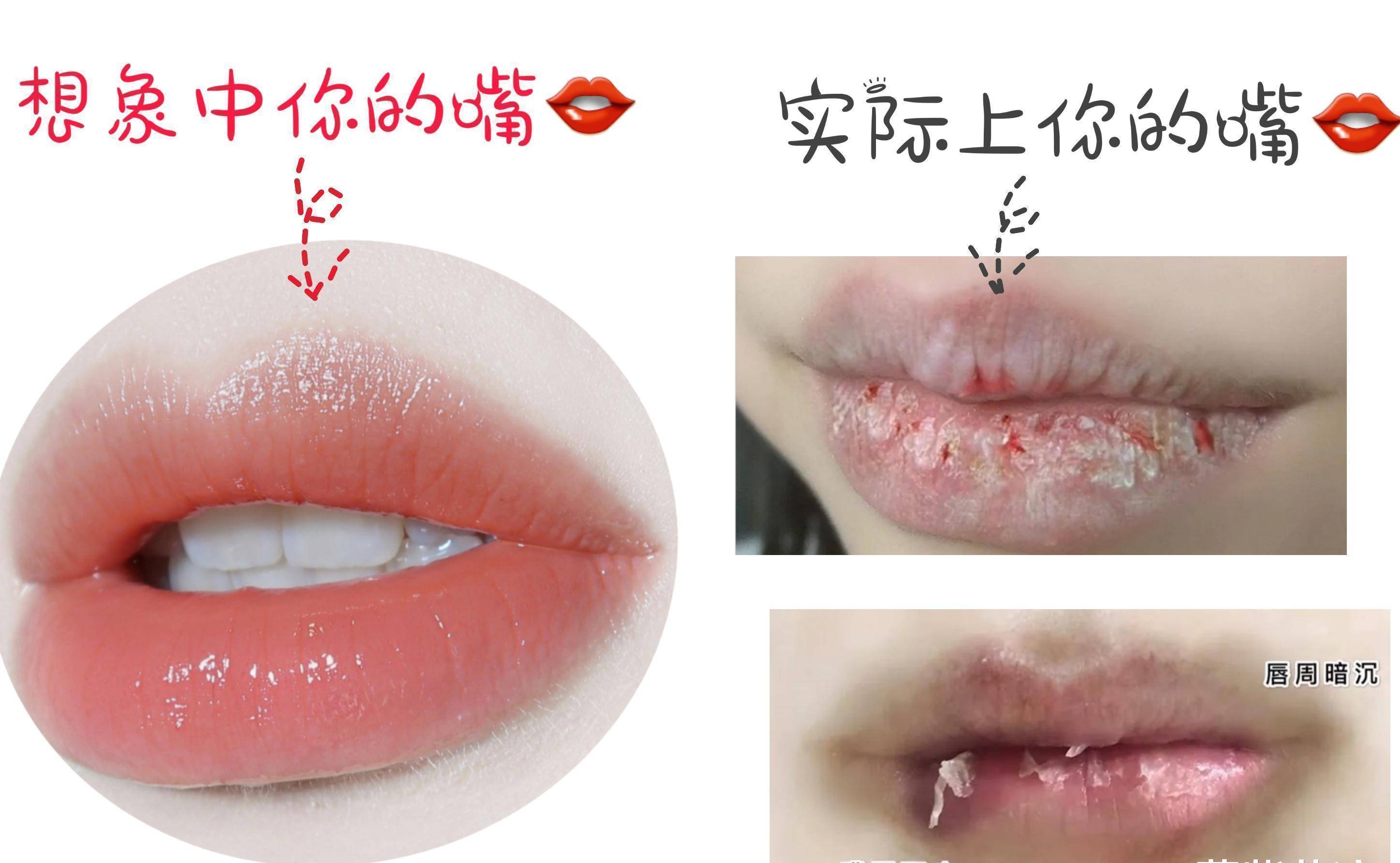 女生不注意这3个细节,太破坏颜值和异性缘了,怪不得会单身!_嘴唇_护理