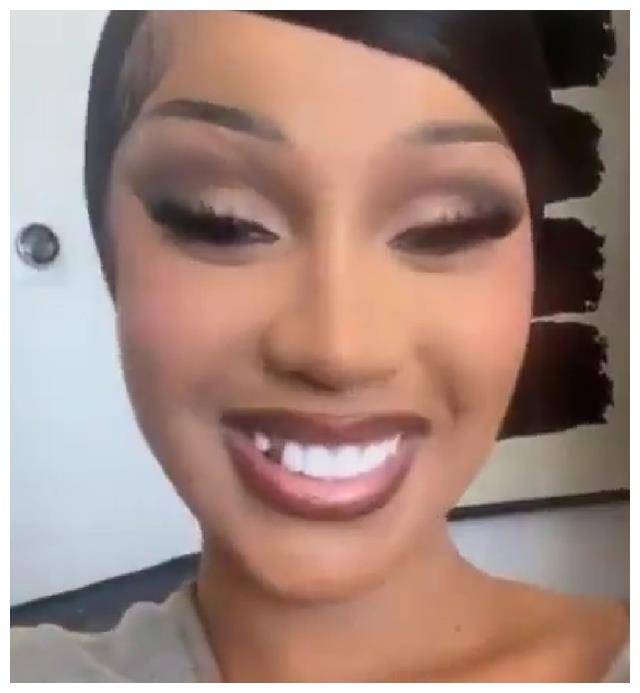 卡迪b不小心摔倒一颗牙丢失网友纷纷心疼