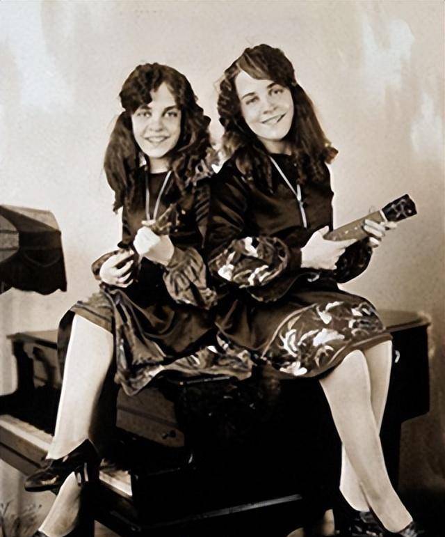 英国臀部连体姐妹各有一名丈夫姐姐死后妹妹与遗体共存2天去世