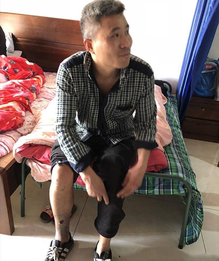 2017年江苏女子离婚两月却突患白血病前夫举债治疗一夜白头