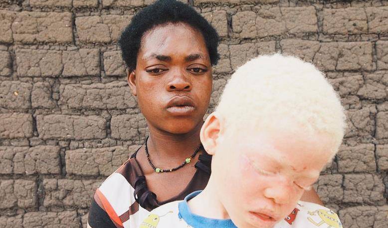 神奇药水,甚至把他们的血液与黄金相比,认为他们的肉体也有神奇的药效