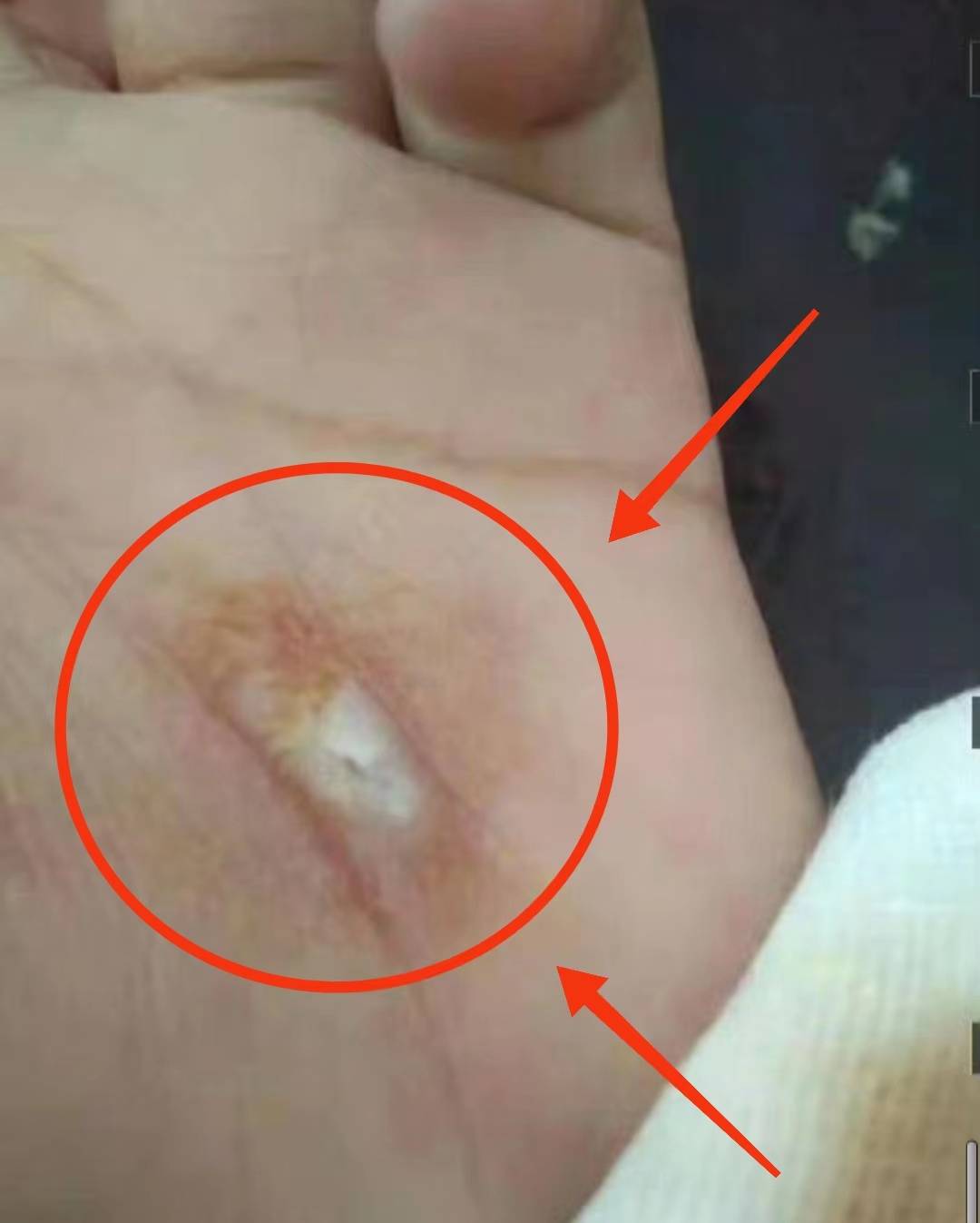 初一女生遭学姐烫伤凌辱7位施暴者6人免责最重的1人才罚500元