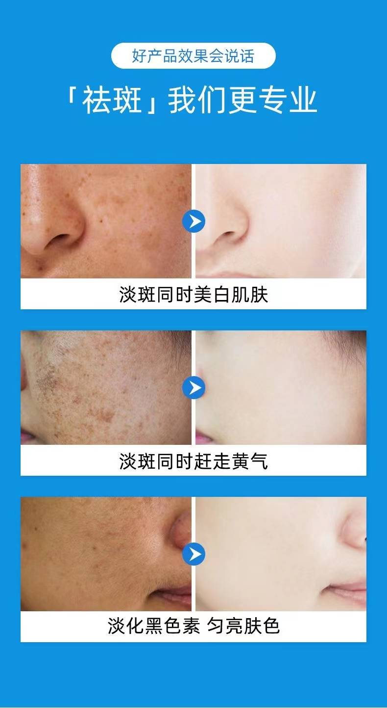 怎么祛斑 来自搜狐网