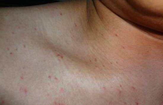 原创原创42岁农民工腹痛入院两个月后肝癌离世提醒1种家常菜要少吃