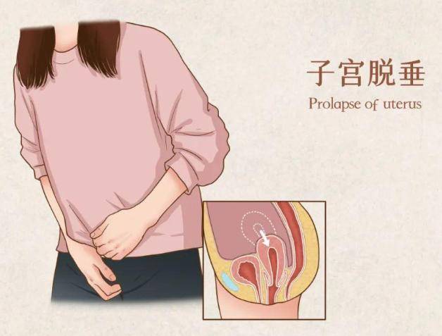 原创女人摘掉子宫后与正常女性有何差异呢医生道出实情