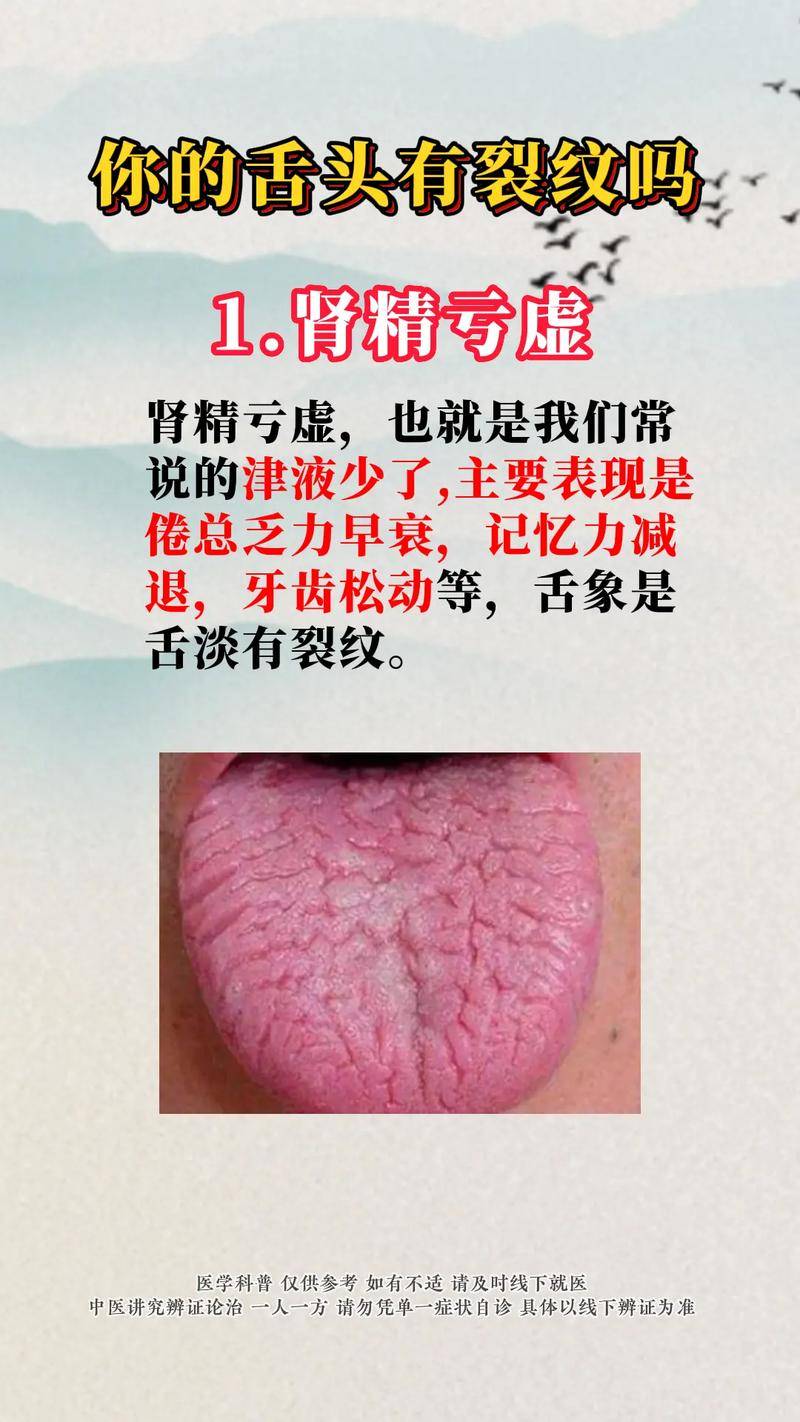  舌頭分叉是什么病_舌頭分叉是什么病的前兆