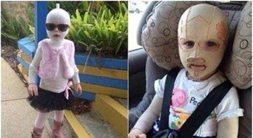 原创她出车祸后每天戴头套上学受尽同学嘲讽摘下头套后众人沉默了