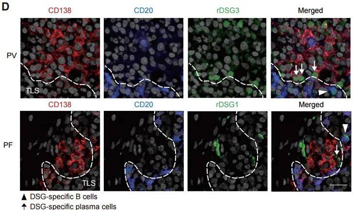 phenocycler41个蛋白靶标皮肤自免病机制揭示天疱疮慢性水疱中tlss微