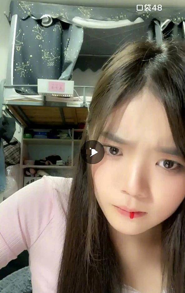 刘丽千在医院接受了妥善的治疗,做了胃镜,拍了片子.