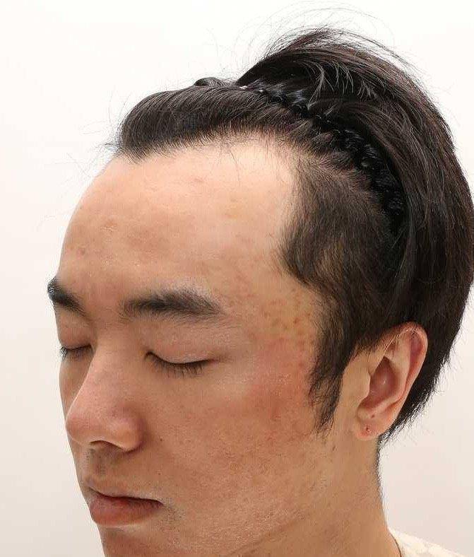 原创网友称华晨宇是自己老公还晒出多张华晨宇植发照片称张碧晨是小三