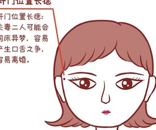 痣相看婚姻,脸上几处不利婚姻的痣,你有吗?