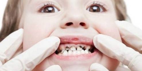 原创宝宝吃糖6大危害你知道几个宝宝科学吃糖注意这3点