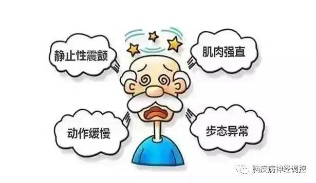 帕金森病的核心症状不是抖而是慢