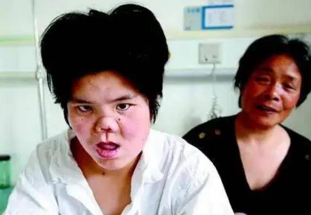 原创1988年陕西农民捡到面部畸形女婴整容变美后嫁给了农民儿子