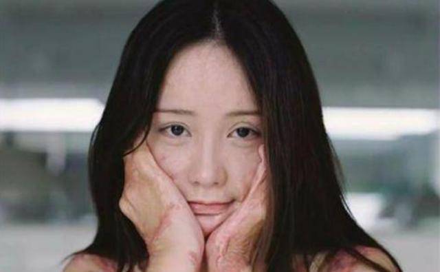 让周岩回复美貌,而这些手术的疼痛,是她必须要去承受的,好在现在的她