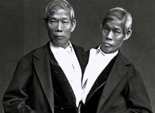 原创华人连体兄弟赴美表演暴富后娶姐妹花生22个孩子