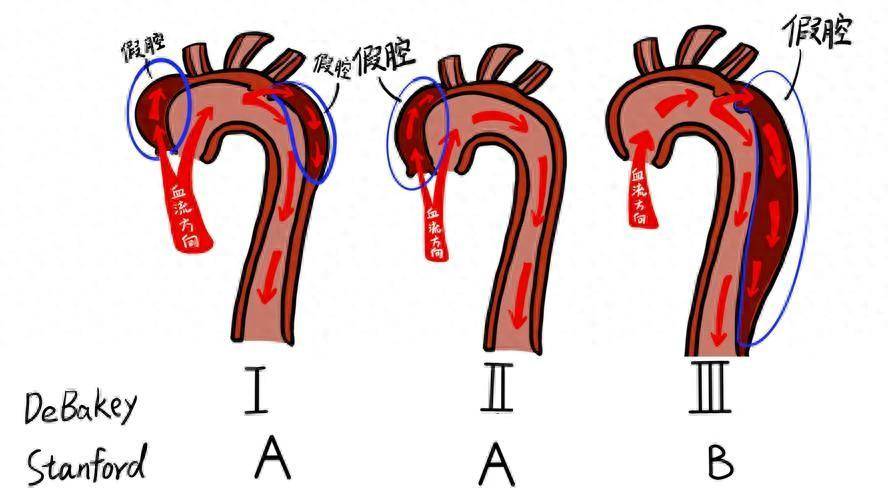 发病率逐年上升,且往往与高血压,动脉硬化等慢性疾病密切相关