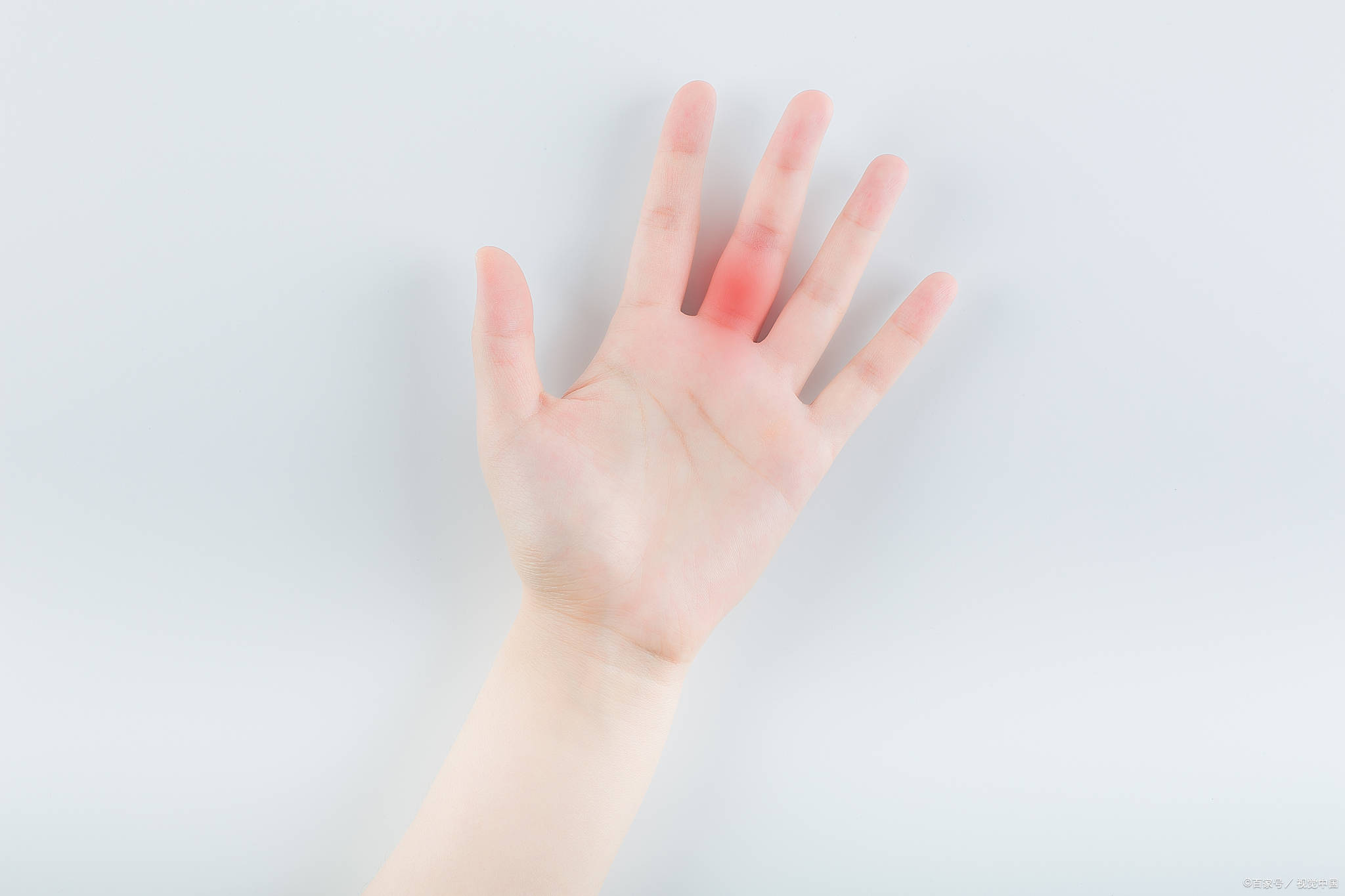 手指头得了腱鞘炎怎么能治好?这样真行_治疗_影响_炎症