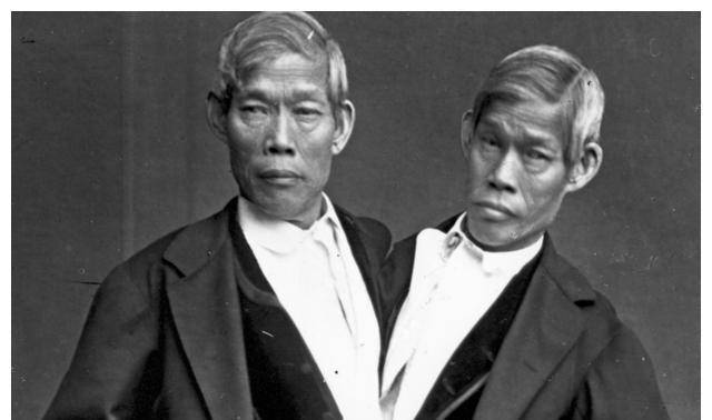 泰国连体兄弟娶了一对姐妹,生育了22个孩子_邦克_罗伯特_皇宫