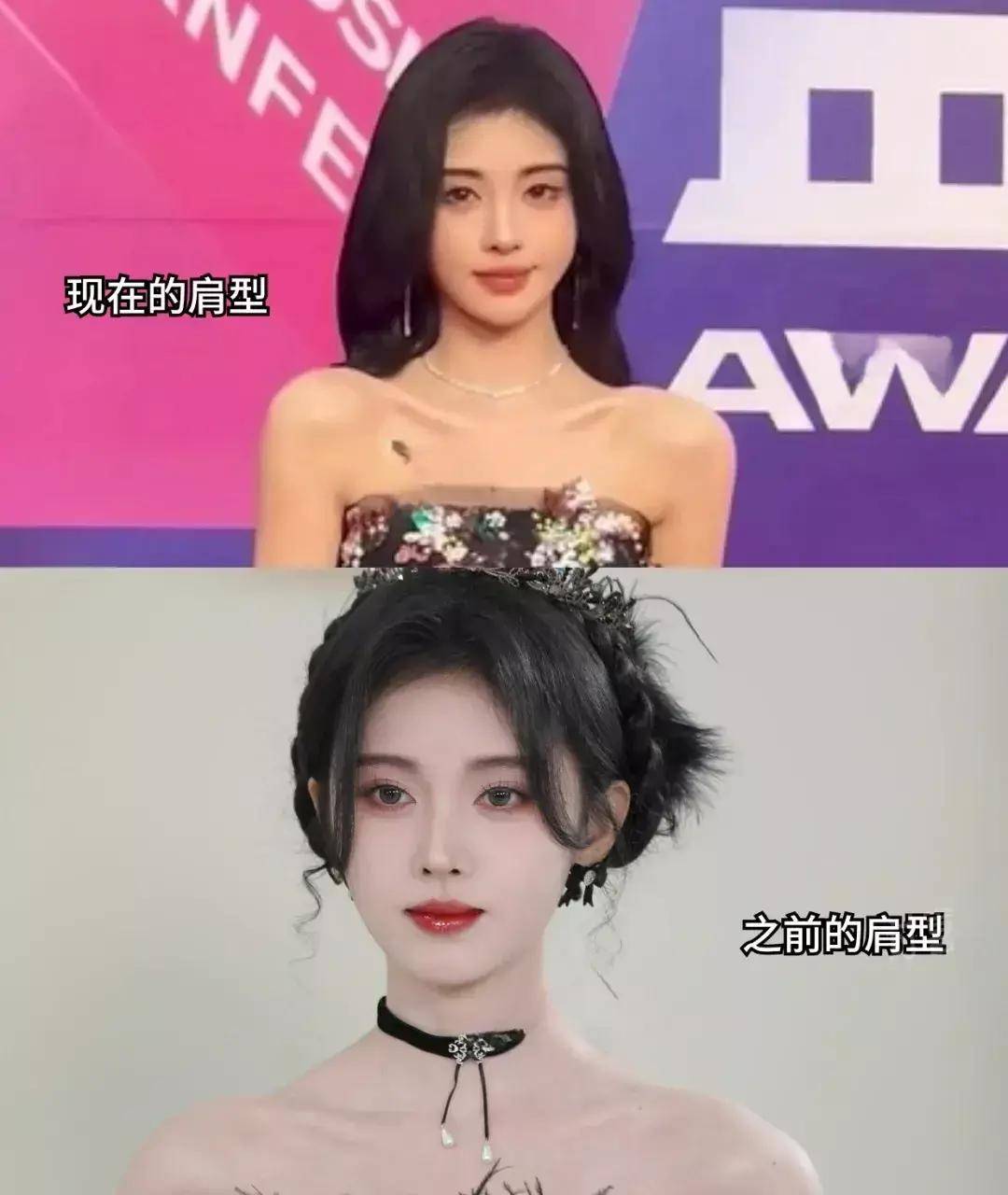 原创鞠婧祎为显头小做了肩膀医美画风诡异突兀网友吐槽畸形审美