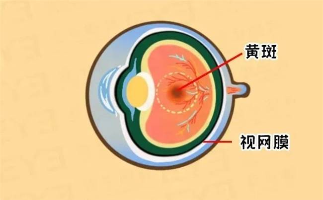 眼睛有黄斑怎么治疗图片