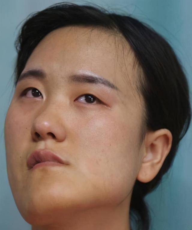 原创东北歪脸女孩赵宏秋整形成功后拒当网红依旧回大山当老师