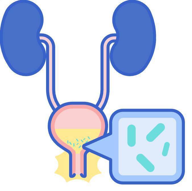 原创尿路感染别不当病9个原因都可能引起感染做好日常防护