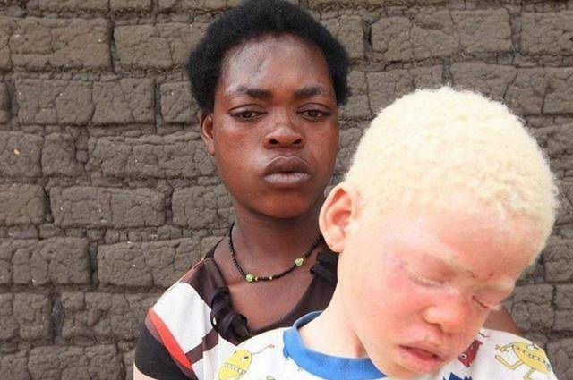 原创非洲最珍贵的一类黑人血液比黄金还贵24小时受警察保护