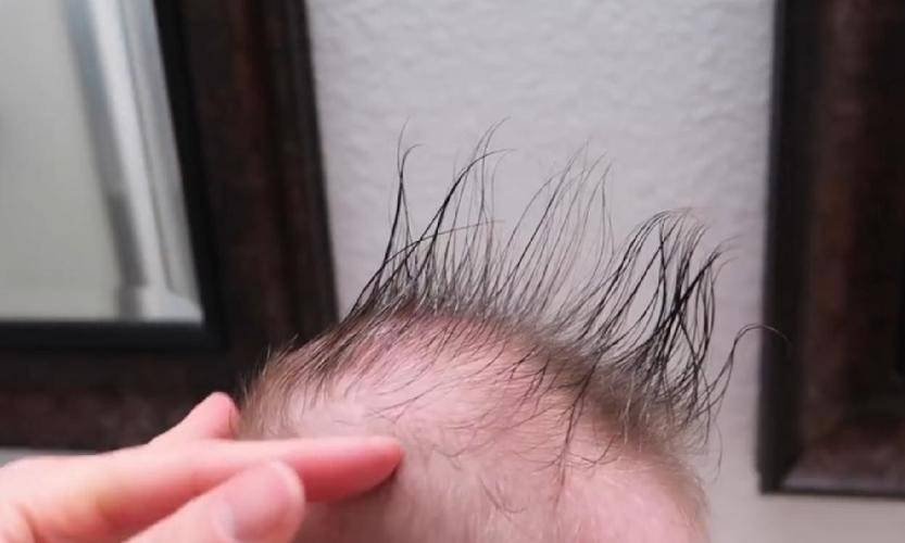 剃光头改善宝宝发质是没有科学依据的！头发浓密与否关系到4点_孩子_睡眠_隐患