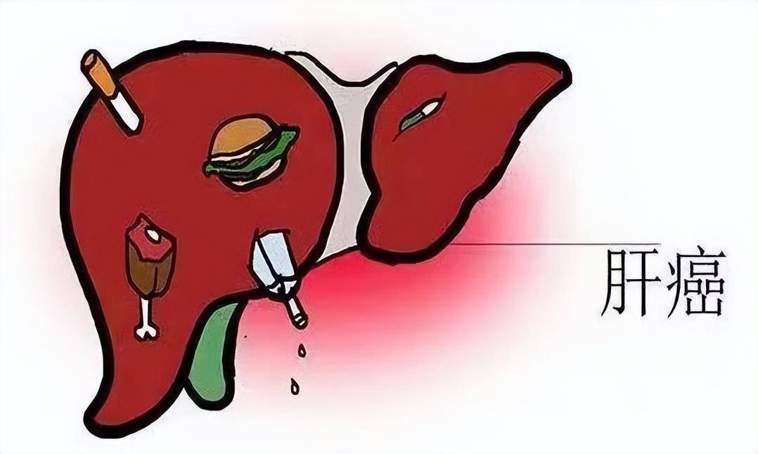 守护健康保护小心肝牢记三要三不要别让健康肝着急