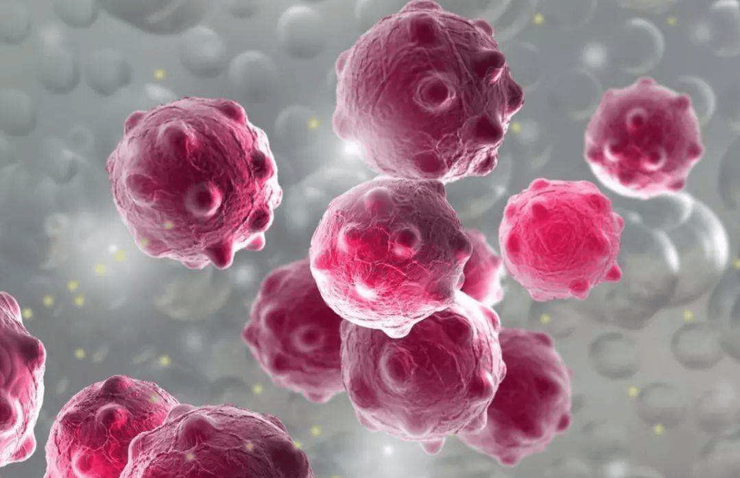 不论男女,身上长出这5种"瘊子",或已感染hpv病毒!千万别轻视