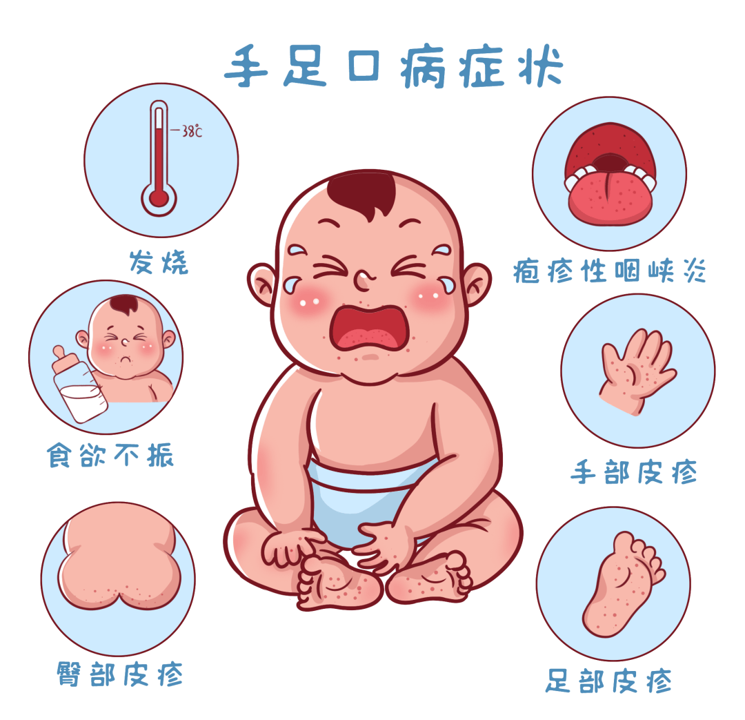 手足口进入高发期,如果得了手足口病,家长应该怎么办?
