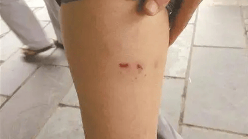 一个月后狂犬病发不治身亡_传播_哺乳动物_患者