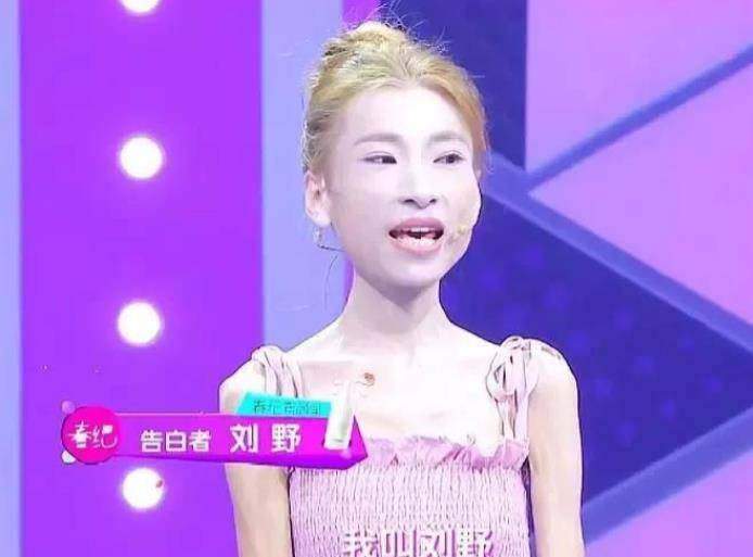 "骷髅妹"刘野:自虐式减肥,120斤减到57斤,直接吓跑网恋对象